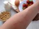 Allergies alimentaires : reconnaître les symptômes qui doivent vous alerter