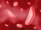 Drépanocytose : comprendre la maladie, ses risques et sa prise en charge (2/3)