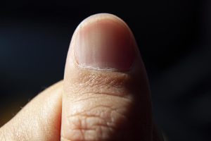 La couleur de vos ongles peut révéler un problème de santé