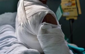 Podor : empêchée d’épouser l’homme qu’elle aime à cause de sa caste, elle s’ébouillante et lutte contre la mort