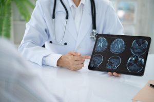 Démence, santé mentale : quel lien avec le microbiote ?